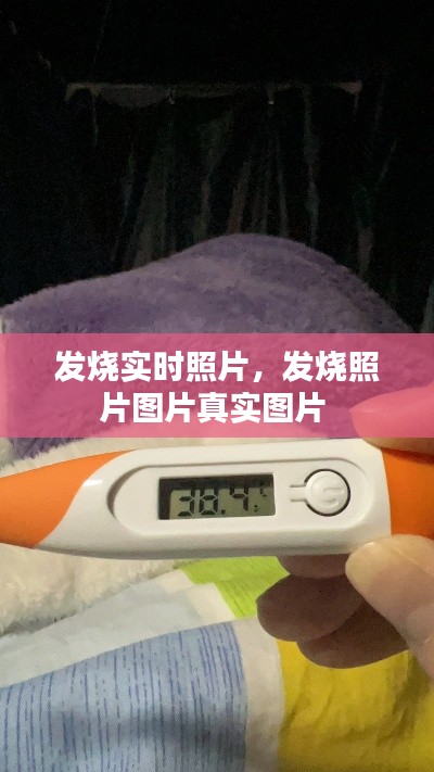 發(fā)燒實(shí)時(shí)照片，發(fā)燒照片圖片真實(shí)圖片 