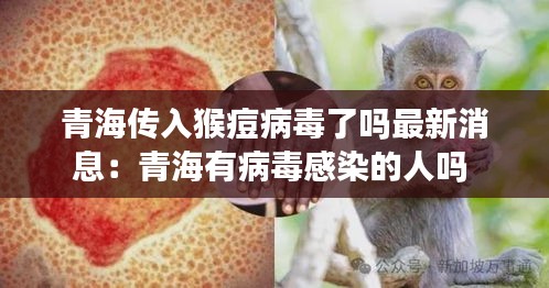 青海傳入猴痘病毒了嗎最新消息：青海有病毒感染的人嗎 
