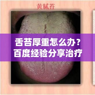 舌苔厚重怎么辦？百度經(jīng)驗(yàn)分享治療小妙招