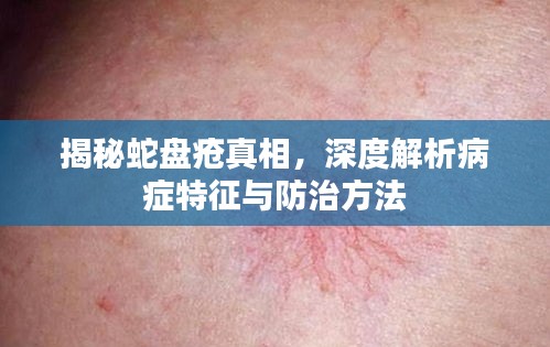 揭秘蛇盤瘡真相，深度解析病癥特征與防治方法