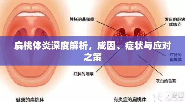 扁桃體炎深度解析，成因、癥狀與應(yīng)對之策